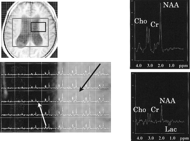 fig 1.