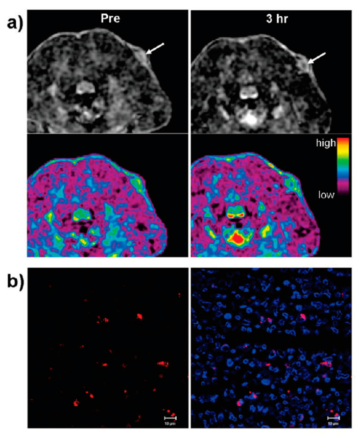 Figure 18