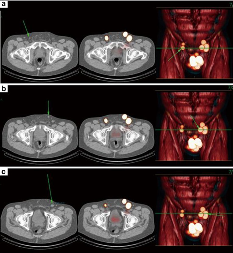 Fig. 2