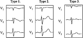 CLC-22386-FIG-0001-b