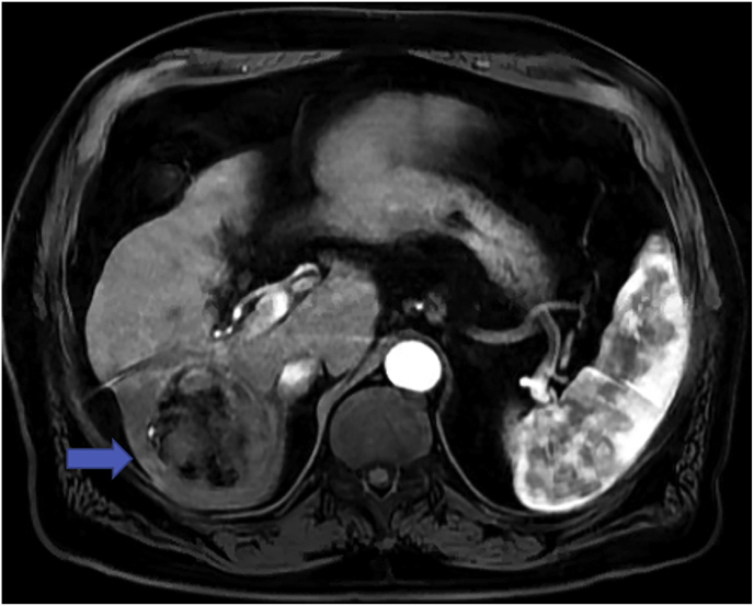 Fig. 3
