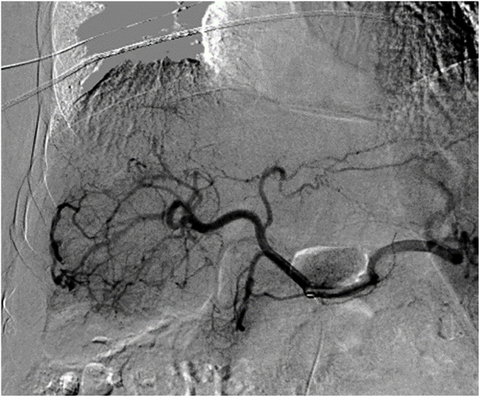 Fig. 3