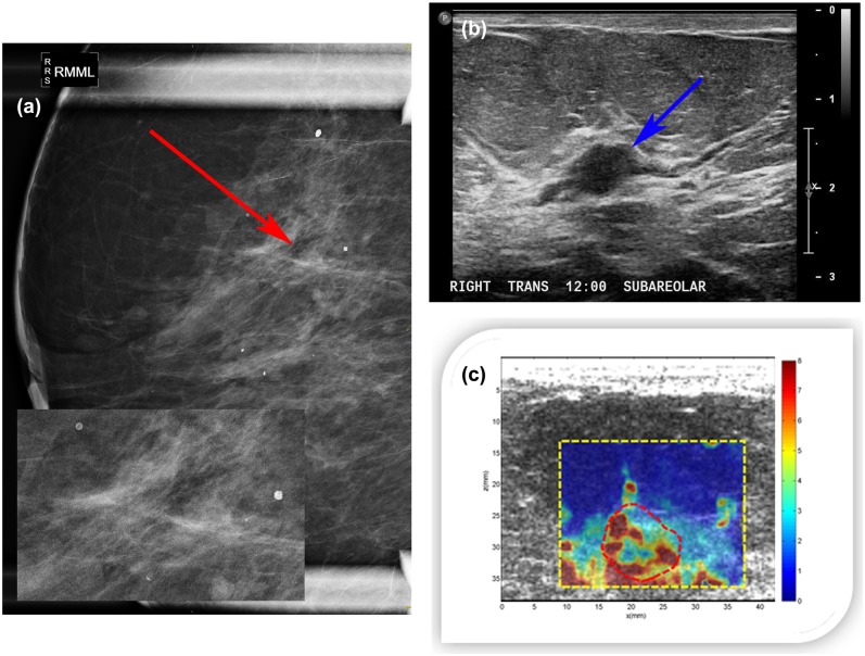 Fig 12