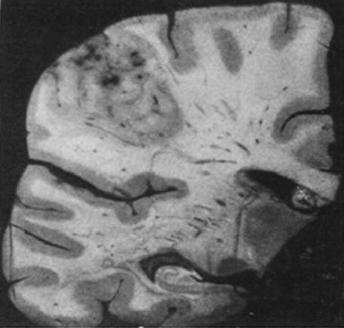 graphic file with name 482_2020_447_Fig5_HTML.jpg