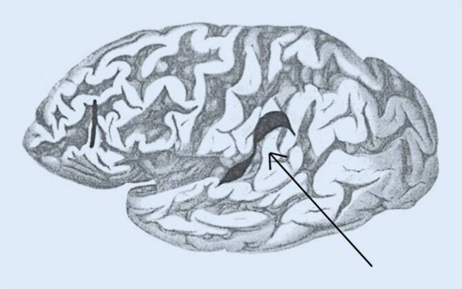 graphic file with name 482_2020_447_Fig4_HTML.jpg