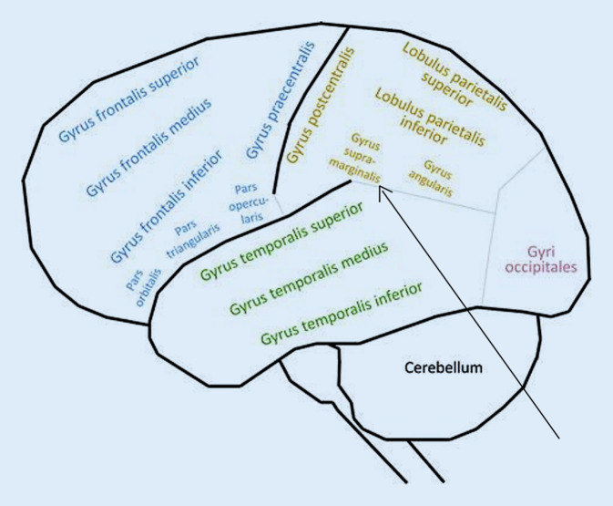 graphic file with name 482_2020_447_Fig3_HTML.jpg