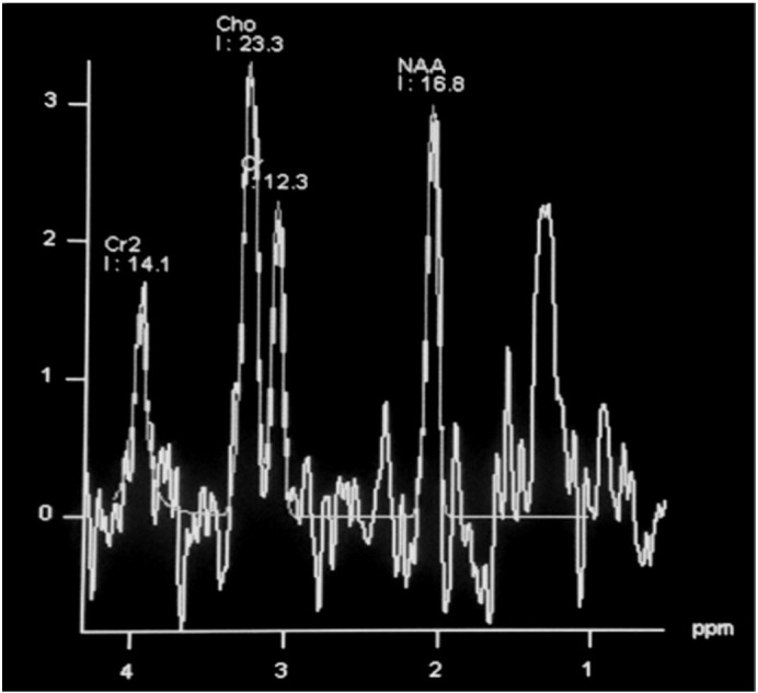 Fig. 2