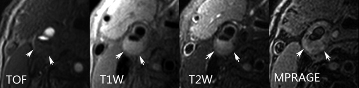 Fig 3.