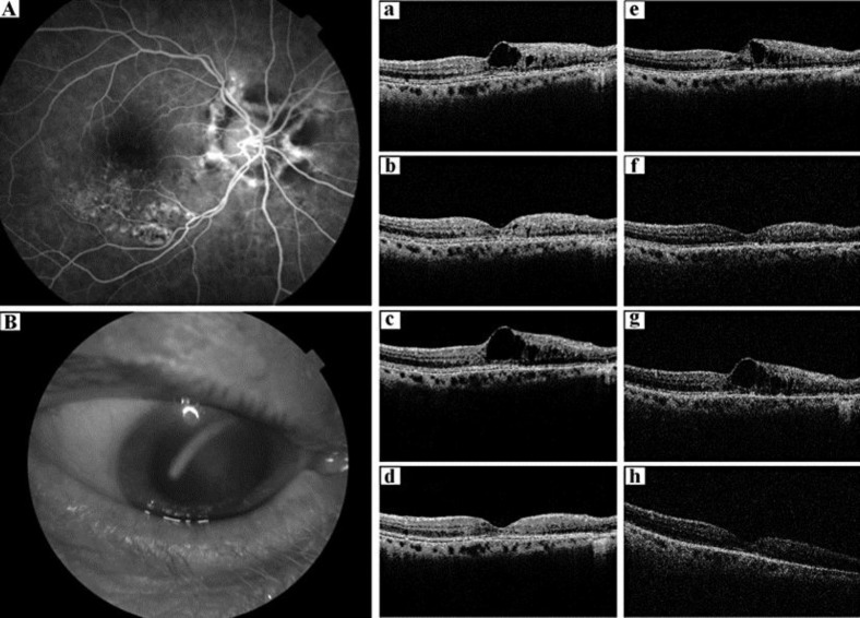 Fig. 1