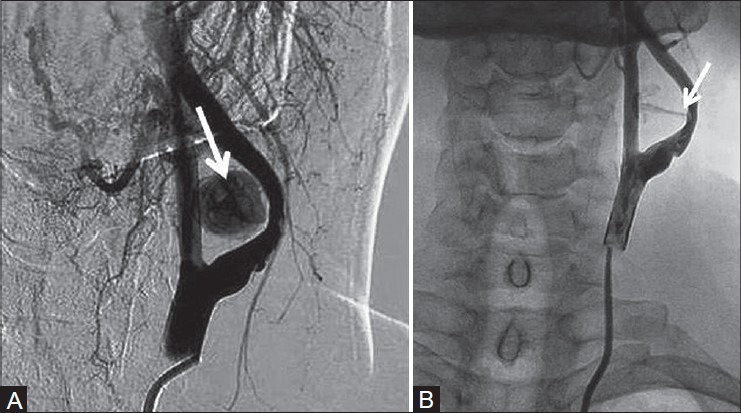 Figure 5(A, B):