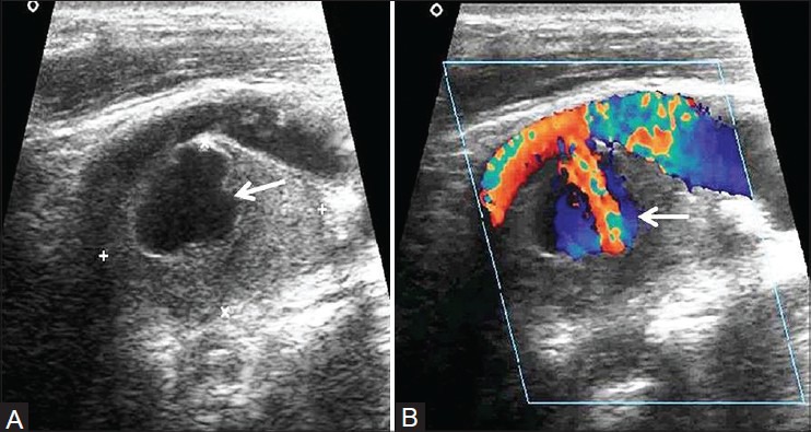 Figure 4(A, B):