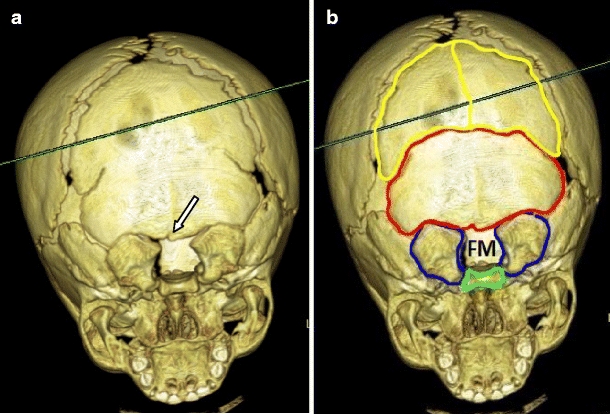 Fig. 2