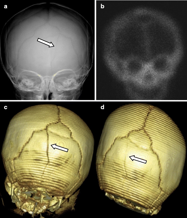 Fig. 8