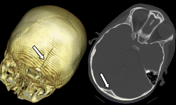 Fig. 7