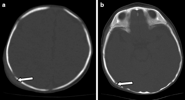 Fig. 6