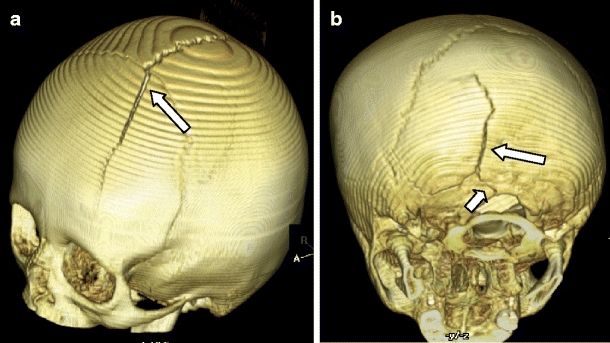 Fig. 4