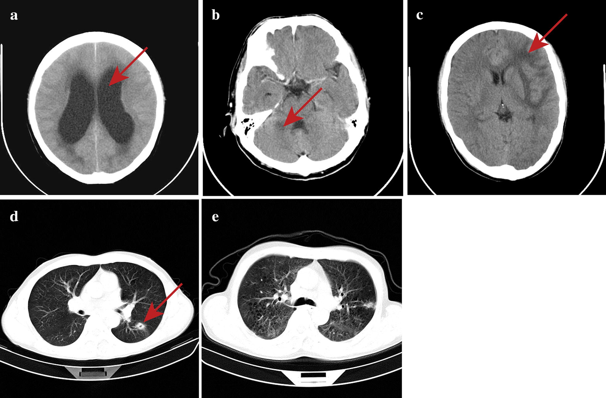 Fig. 1