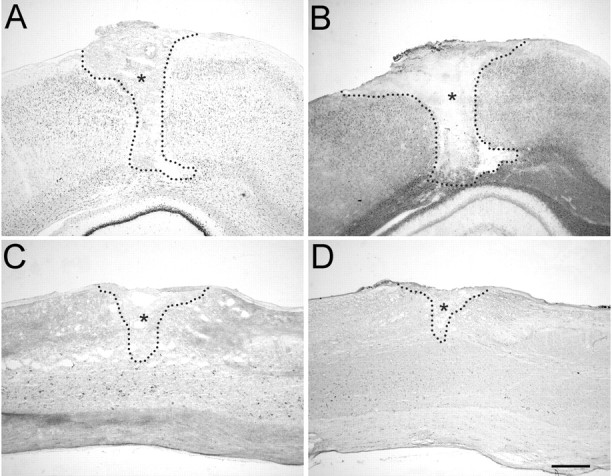 Fig. 11.