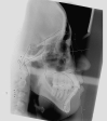 Figure 11.