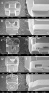 Figure 4. Top view, SEM images of five types of bracket, at 20× (left column) and 100× (right column). (A) (F), Omni-arch (conventional bracket). (B) (G), Clippy (ASLB). (C) (H), Carriere (PSLB). (D) (I), Damon (PSLB). (E) (J), Tenbrook T1 (PSLB).