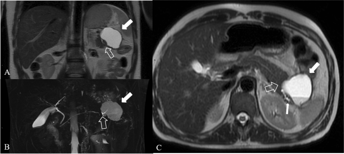 Fig. 14