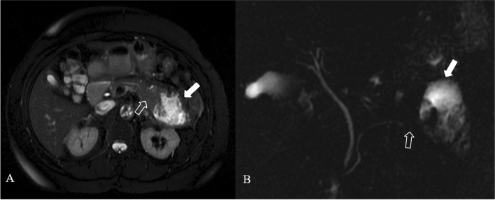 Fig. 13