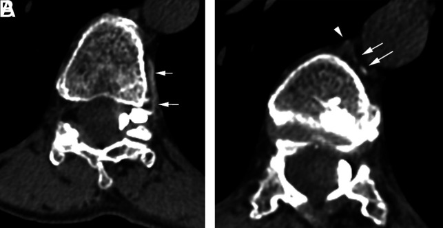 FIG 2.