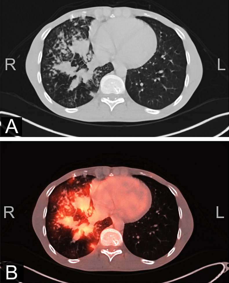 Figure 1