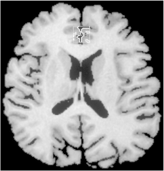 Fig. 1