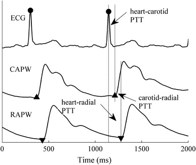 Fig. 1