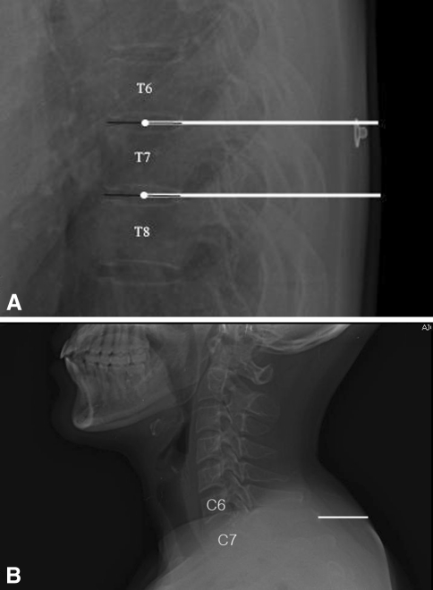 Fig. 2A–B