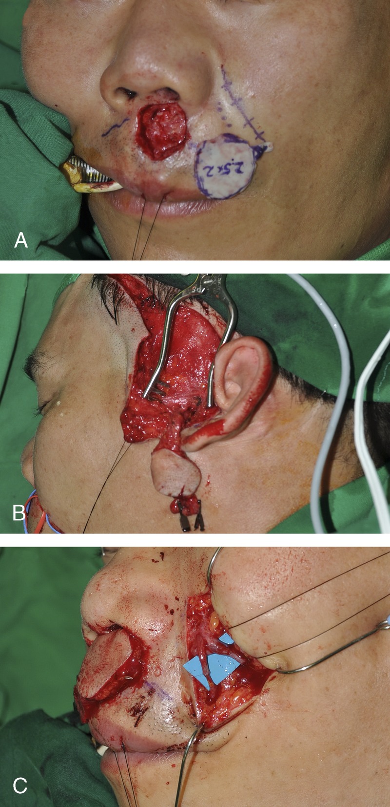 FIGURE 2