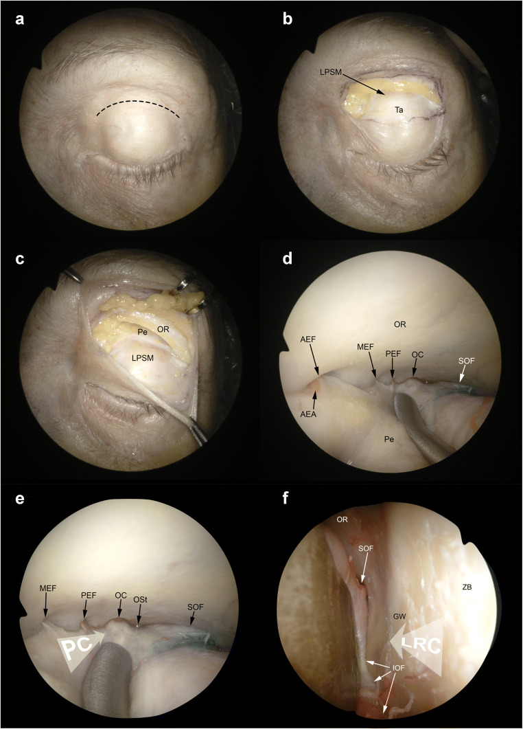 Fig. 5