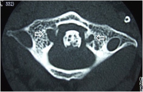 Fig. 2