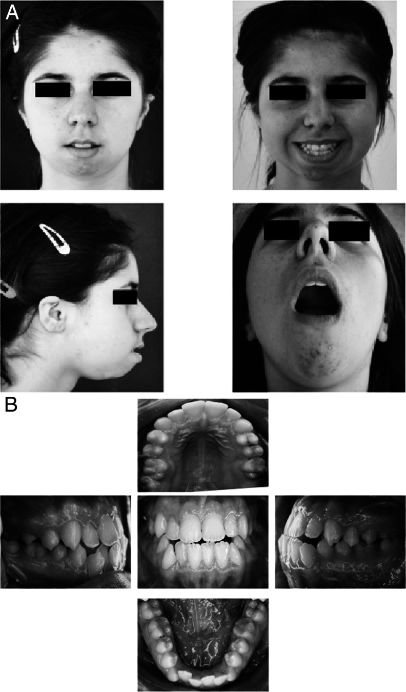 Figure 15