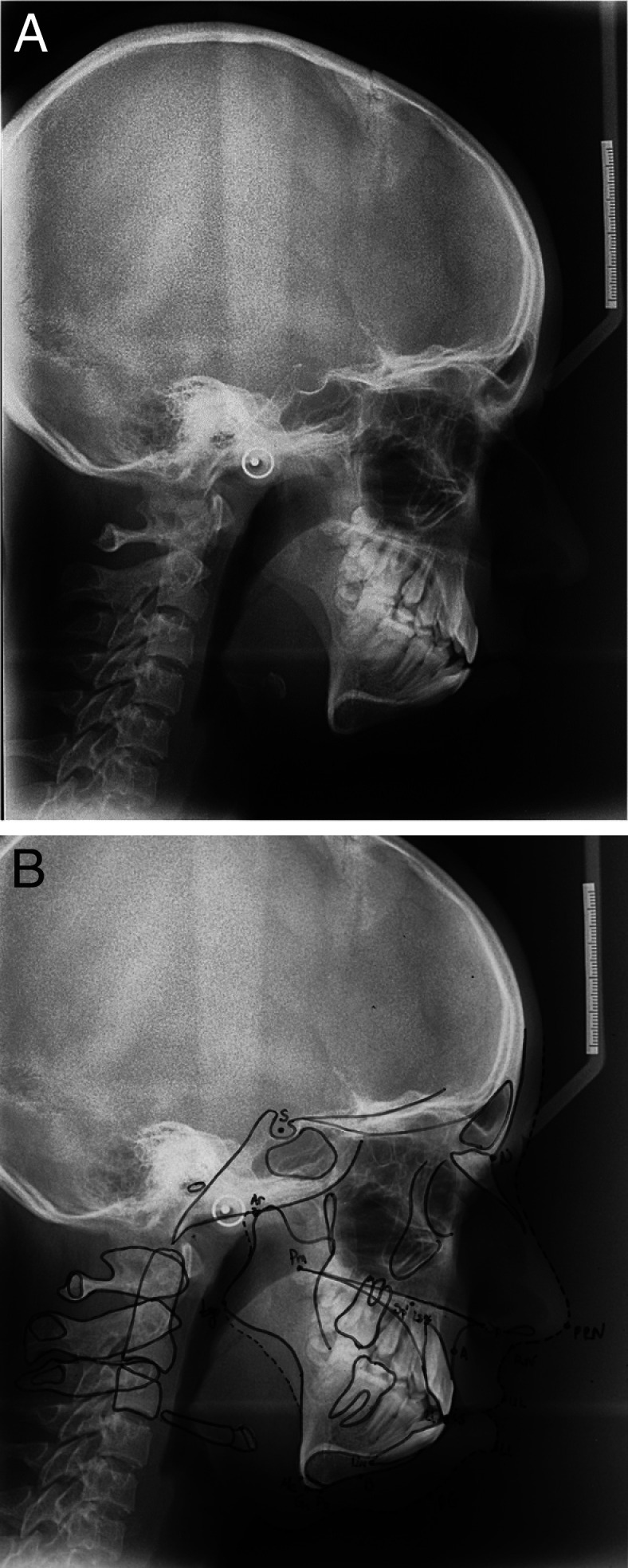 Figure 16