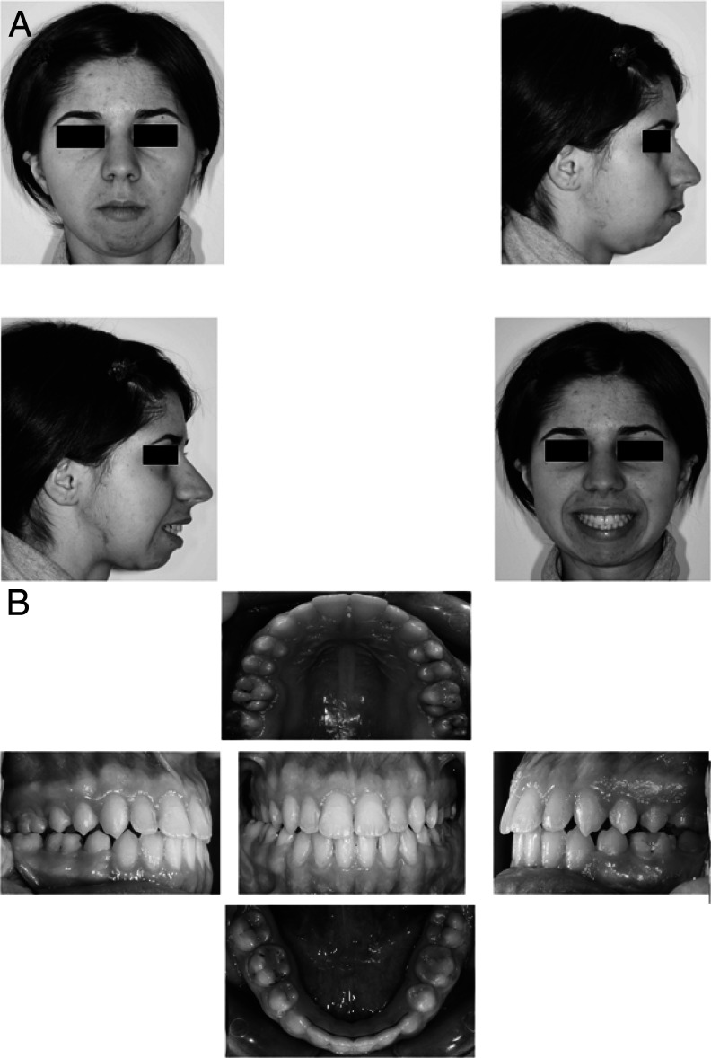 Figure 17