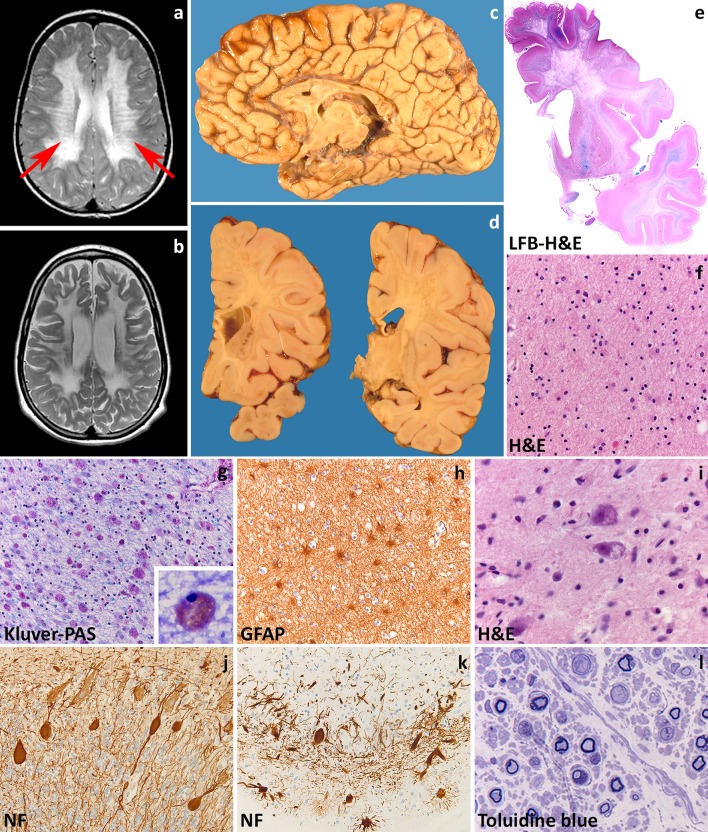 Fig. 1