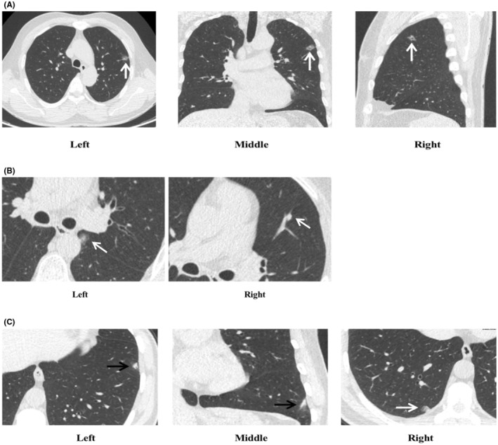 FIGURE 3