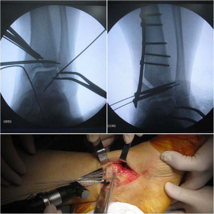 Fig. 2