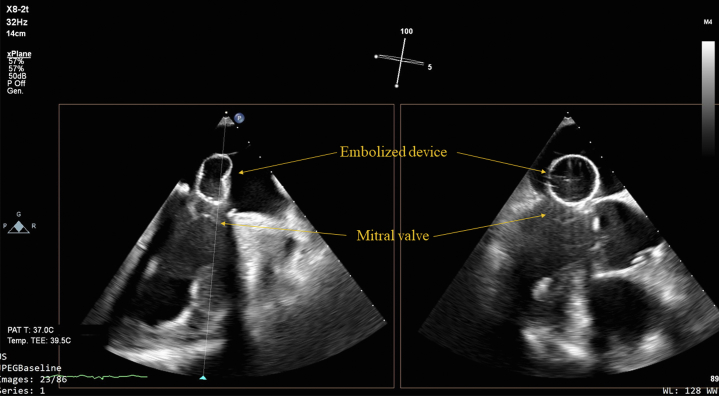 Figure 2