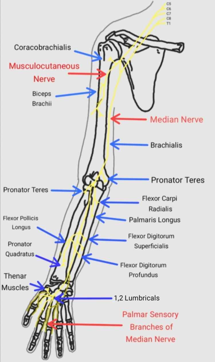 Lacertus Fibrosus Syndrome: A Case Report - PMC