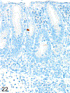 Figure 22.