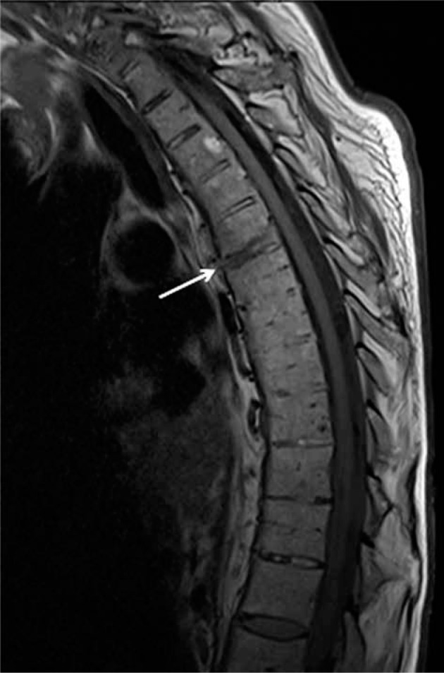 Figure 18