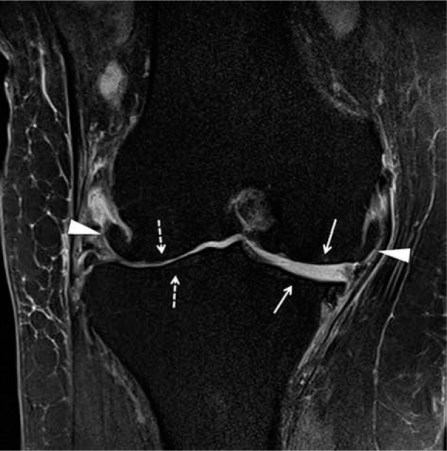 Figure 22