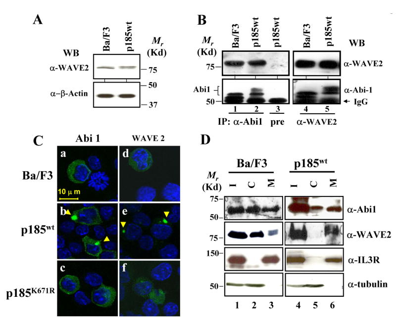 BCR-ABL Induces Abnormal Cytoskeleton Remodeling, β1 Integrin ...