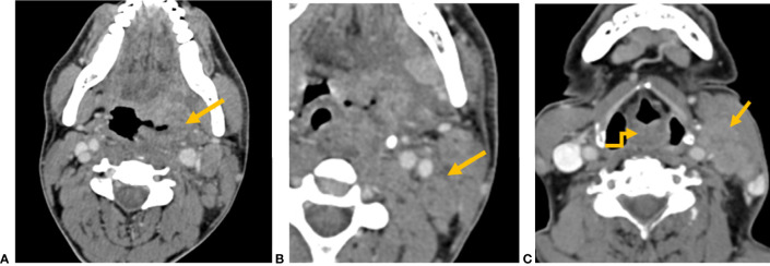 Figure 4