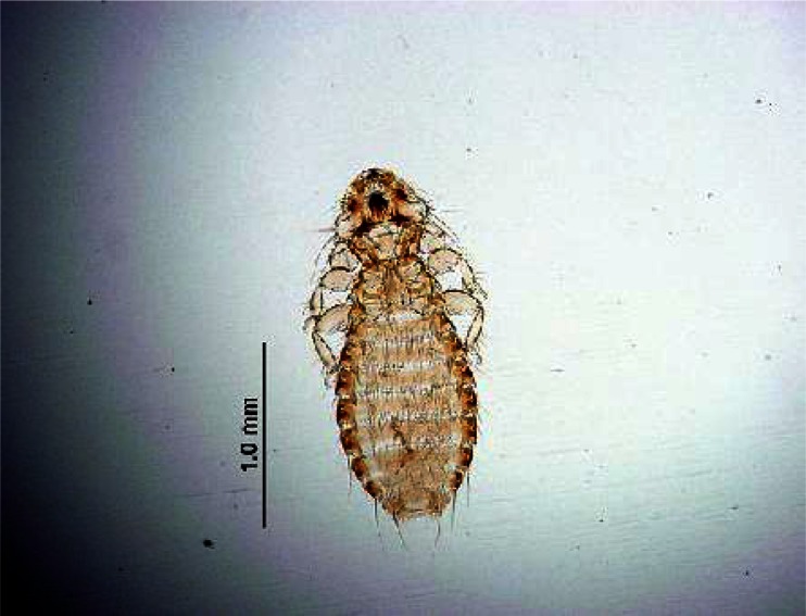 Fig. 12