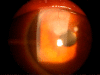Fig. (2).