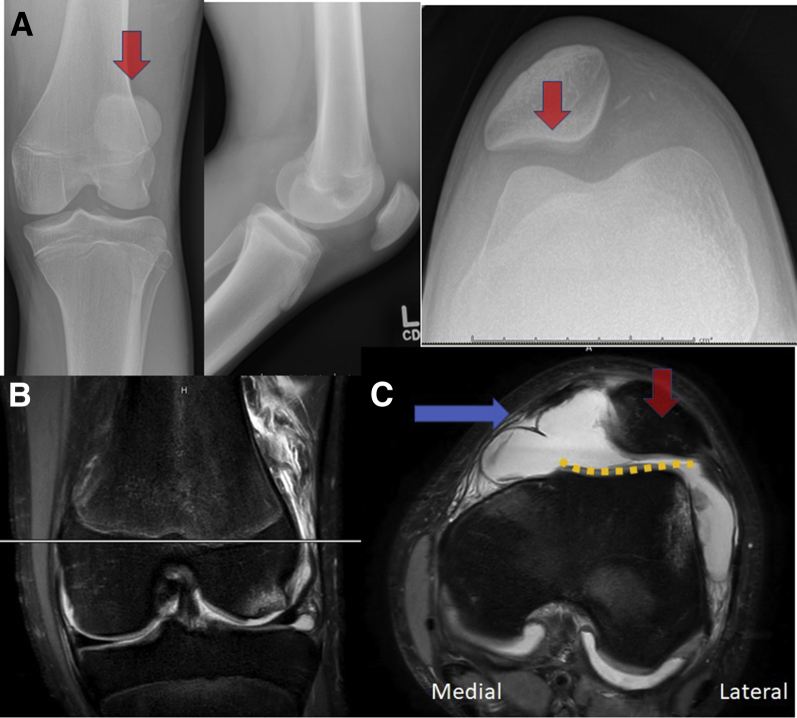 Fig 1